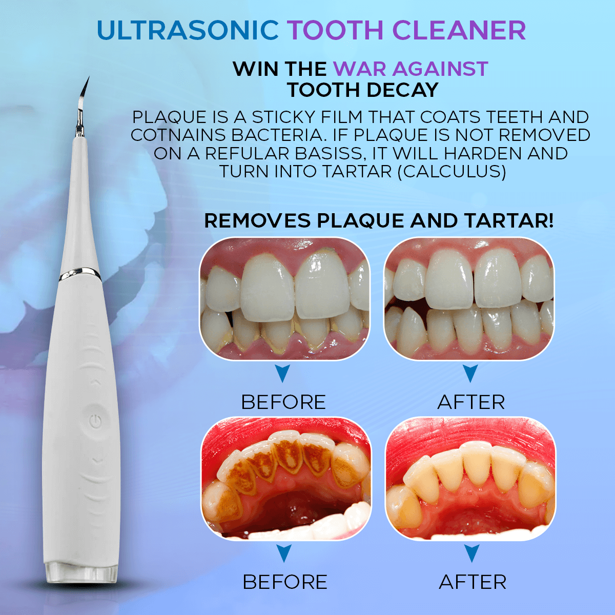 Ultrasonic Tooth Cleaner - Remove Plaque & Stains at Home