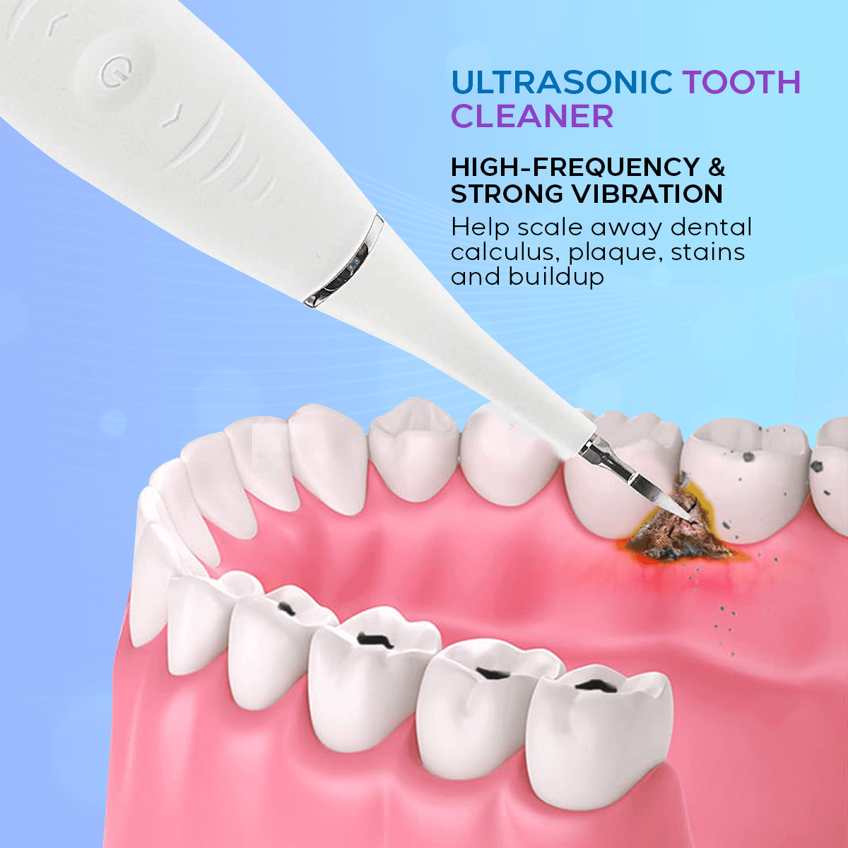 Ultrasonic Tooth Cleaner - Remove Plaque & Stains at Home